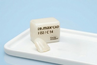 Восстановление зуба коронкой e-max