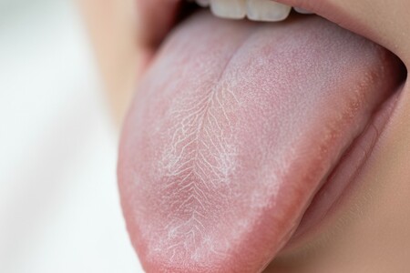 Причины налета на языке