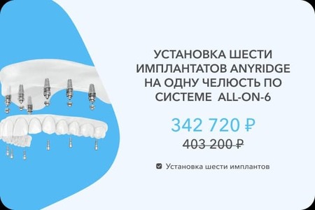 6 имплантов Эниридж
