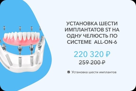 6 имплантов СТ
