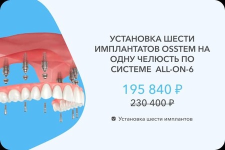 6 имплантов Остем