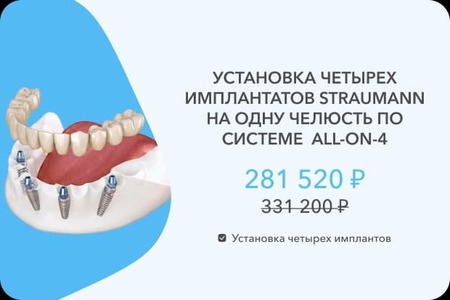 4 импланта Штрауман