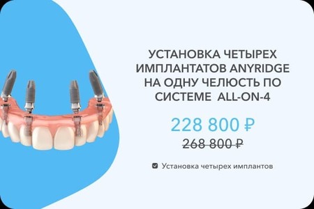 4 импланта Эниридж