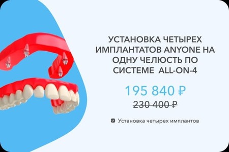 4 импланта Эниван