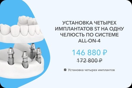 4 импланта СТ