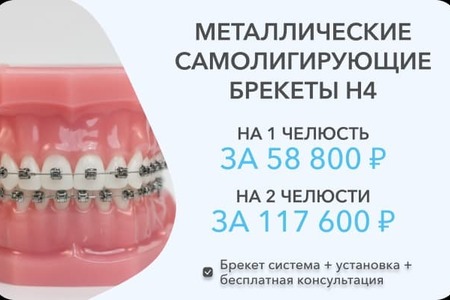 Брекеты Н4