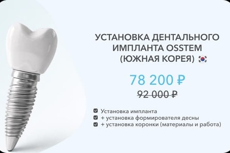 имплант осстем
