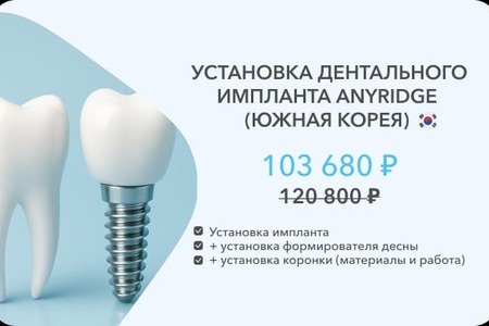 имплант эниридж