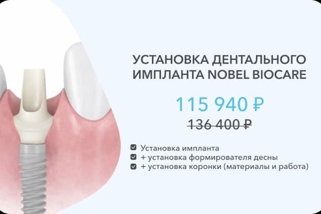 имплант нобель